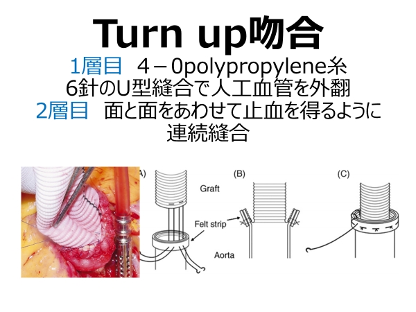 大血管疾患に対する治療1