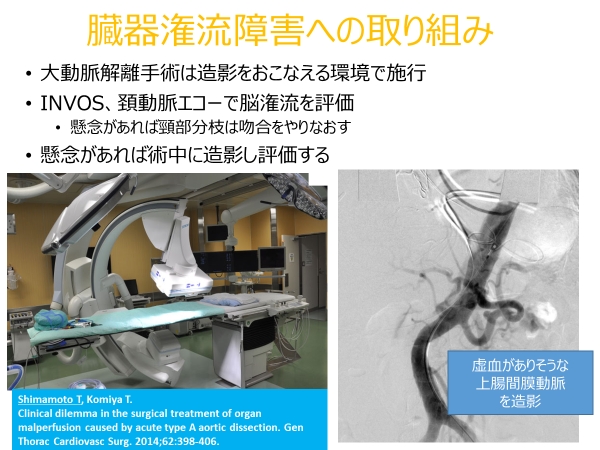 大血管疾患に対する治療2