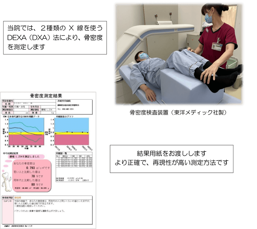 骨密度検査