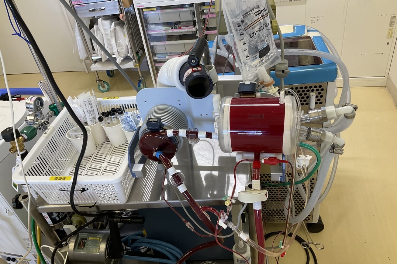 補助循環（ECMO）の管理